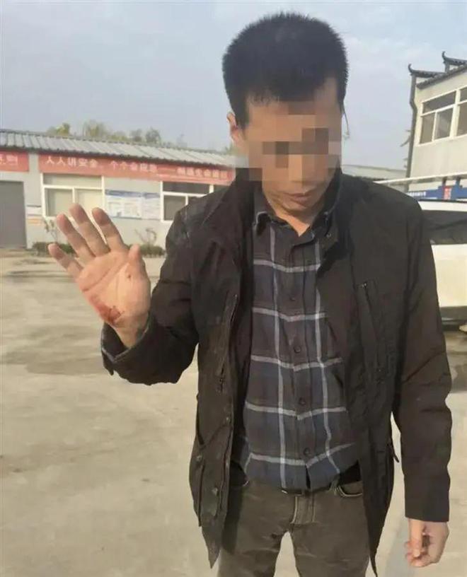 遭袭的调查记者王文志：从业22年八获中国新闻奖被称为“硬汉记者”